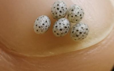 We bestelden een salade, maar er zaten kleine zwarte stipjes in het eten – we zijn meteen naar het ziekenhuis gegaan.