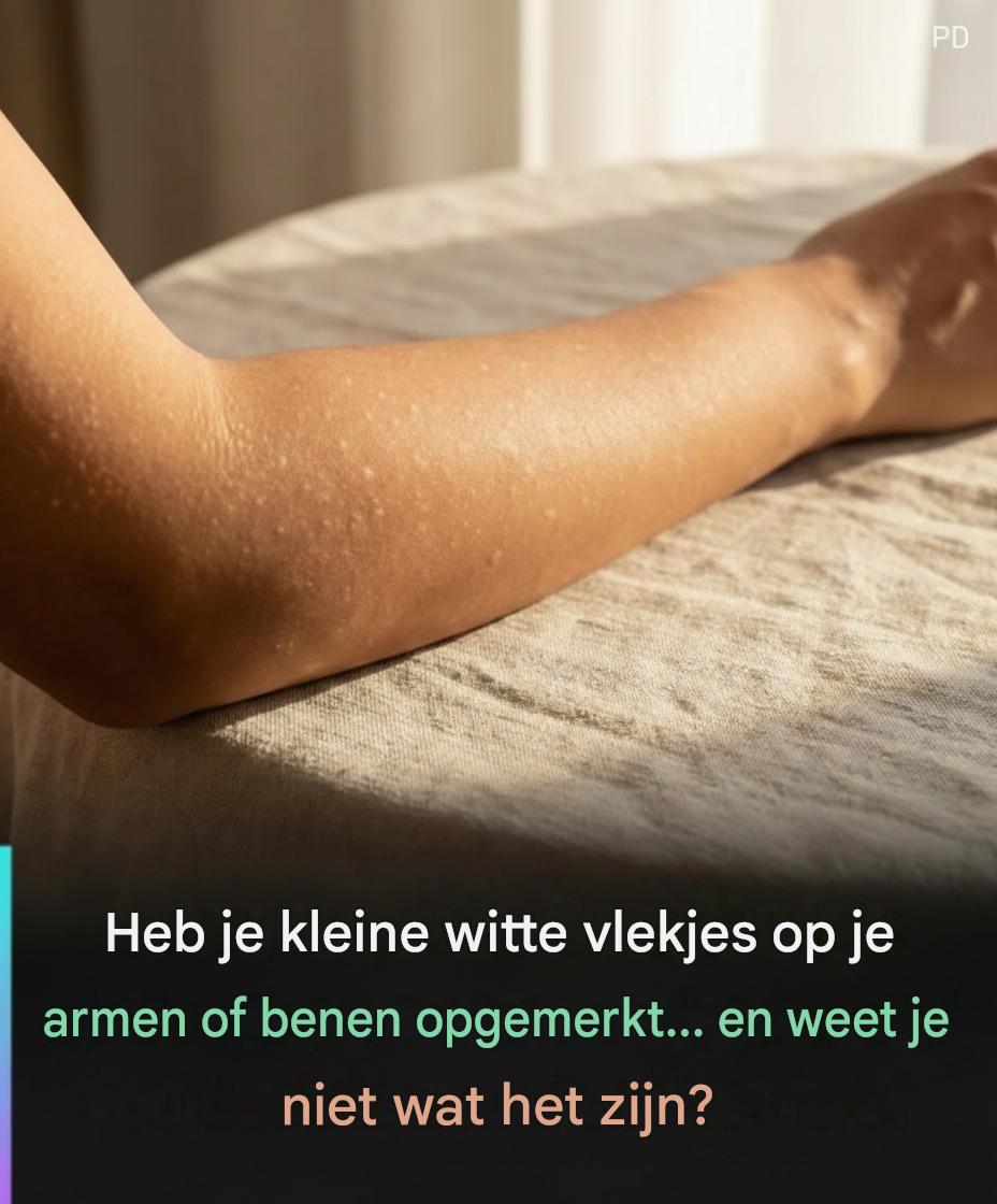 Welke vitaminetekorten kunnen leiden tot witte vlekken op de huid?