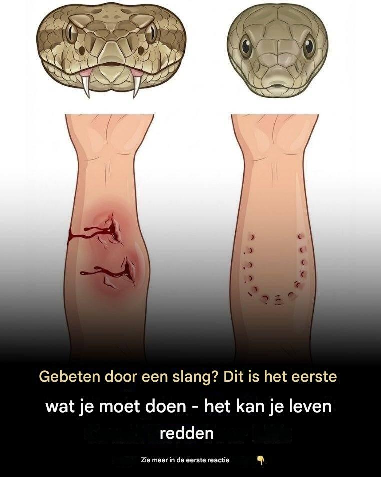 Gebeten door een slang? Dit is het eerste wat u moet doen — het kan uw leven redden.