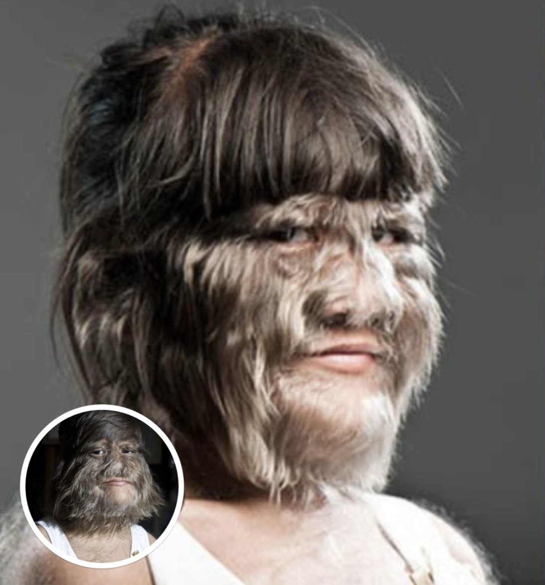 Het ‘harigste meisje ter wereld’ scheert al haar haar af na het ontmoeten van haar soulmate. Zo ziet ze er nu uit.