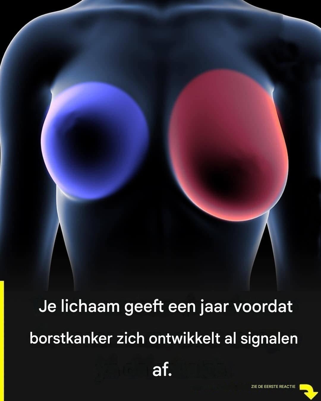 Borstkanker: 4 vroege signalen die elke vrouw moet kennen.