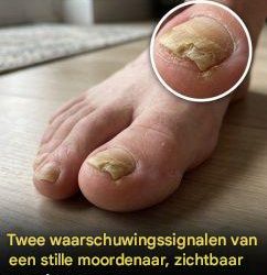 Je moet weten wanneer je een arts moet raadplegen.😳👇