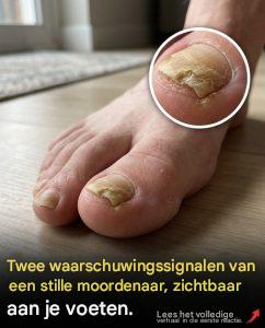 Je moet weten wanneer je een arts moet raadplegen.😳👇