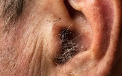Wist je dat haargroei op je oren geen teken van ziekte of een mysterie is, maar een natuurlijk gevolg van veroudering, hormonen, genetica en de tijd die gedurende vele decennia in het menselijk lichaam in werking is getreden?