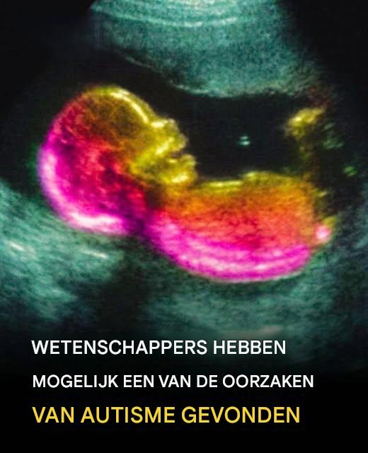 Studie wijst op mogelijke link met de ontwikkeling van autisme