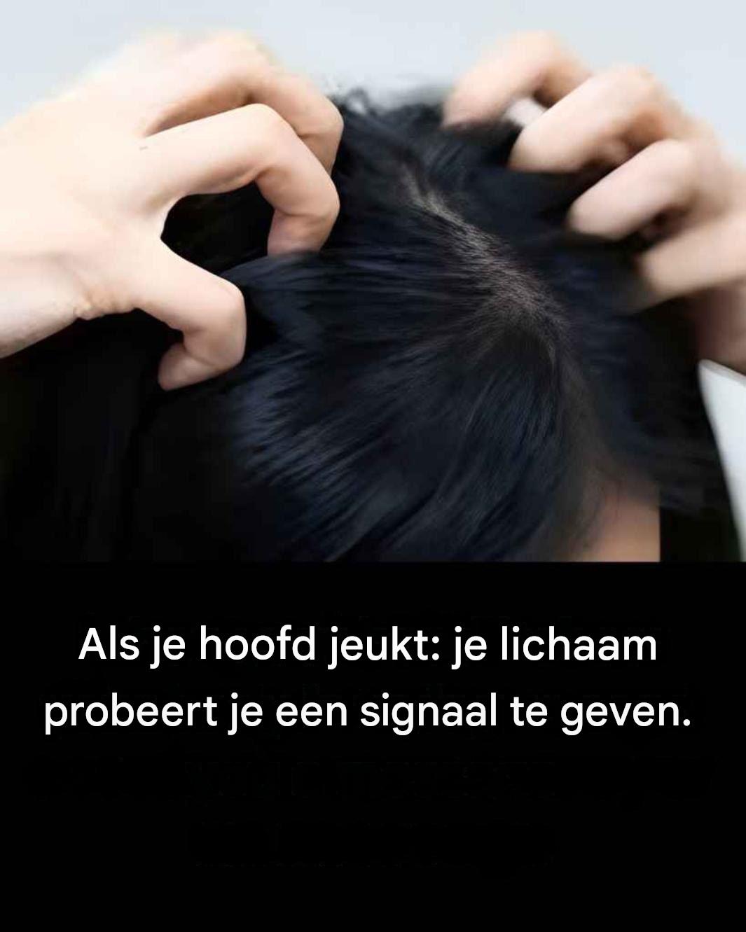 Jeuk aan je hoofd? Dit zijn de belangrijkste oorzaken.