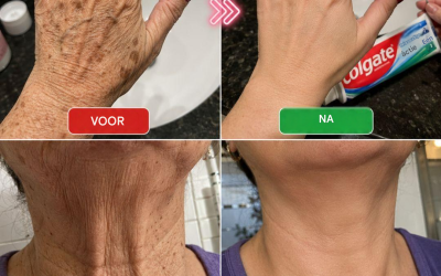 “Het lijkt wel alsof ik een operatie heb ondergaan”: een huismiddeltje om rimpels en donkere vlekken op handen en armen te verminderen.