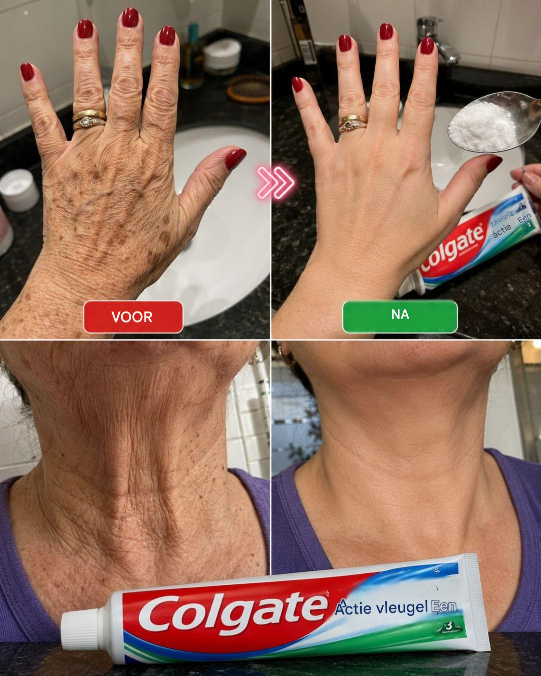 “Het lijkt wel alsof ik een operatie heb ondergaan”: een huismiddeltje om rimpels en donkere vlekken op handen en armen te verminderen.