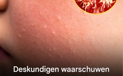 Experts onthullen de verborgen betekenis achter mysterieuze witte vlekken op je huid en wat ze zeggen over je gezondheid.