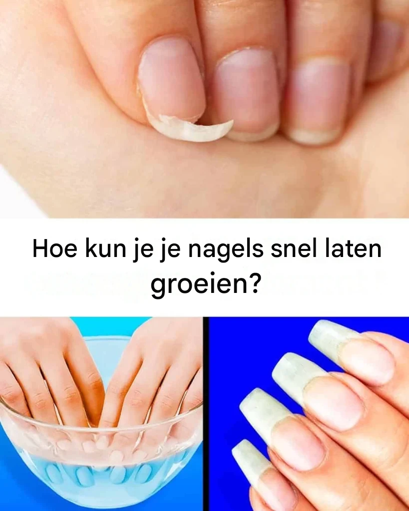 De geheimen voor gezond groeiende nagels