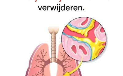 7 voedingsmiddelen die de luchtwegen op natuurlijke wijze vrijmaken