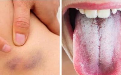 11 signalen die aangeven dat je lichaam je belangrijke waarschuwingen geeft