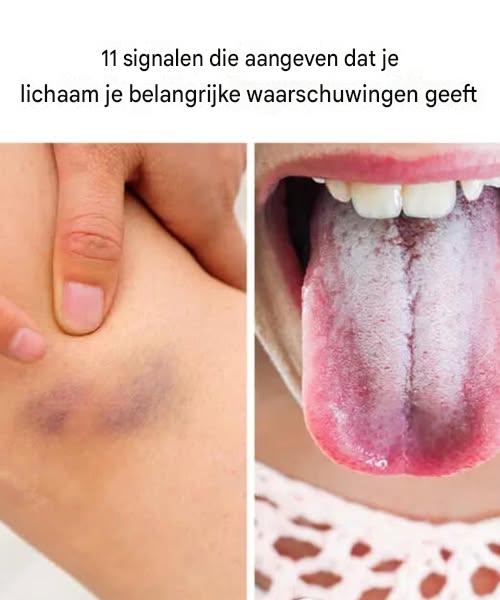 11 signalen die aangeven dat je lichaam je belangrijke waarschuwingen geeft