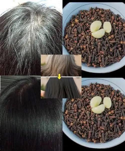 Hoe knoflook en kruidnagel kunnen helpen om grijs haar op natuurlijke wijze tegen te gaan.