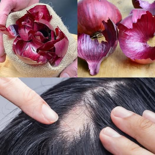 5 eenvoudige zelfgemaakte conditioners om je haar als gegoten te herstellen