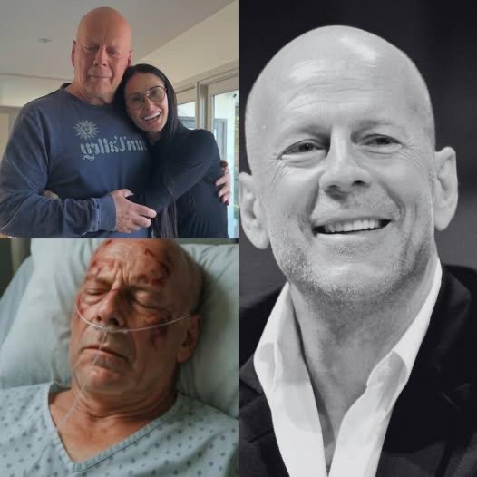 Familieleden hebben bevestigd dat voormalig acteur Bruce Willis het heeft gehad!