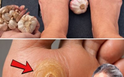 9 verrassende manieren waarop knoflook op natuurlijke wijze kan bijdragen aan gezondere voeten thuis