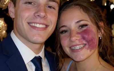 Slechts één jongen vroeg me mee naar het schoolbal, omdat niemand anders met me wilde gaan vanwege de moedervlek op mijn gezicht. Iedereen lachte, totdat er politieagenten de gymzaal binnenkwamen.