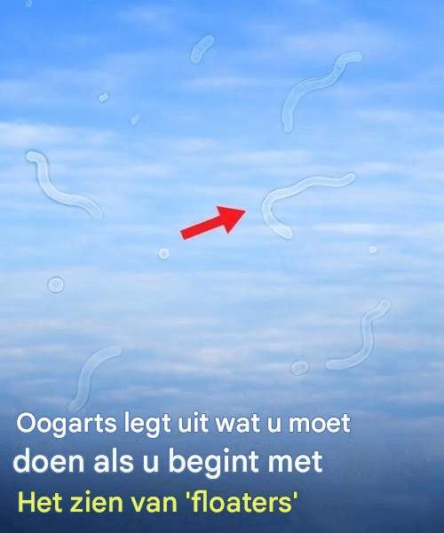 Oogfloaters: wat ze zijn en wat u moet doen als u ze opmerkt, volgens een oogarts.
