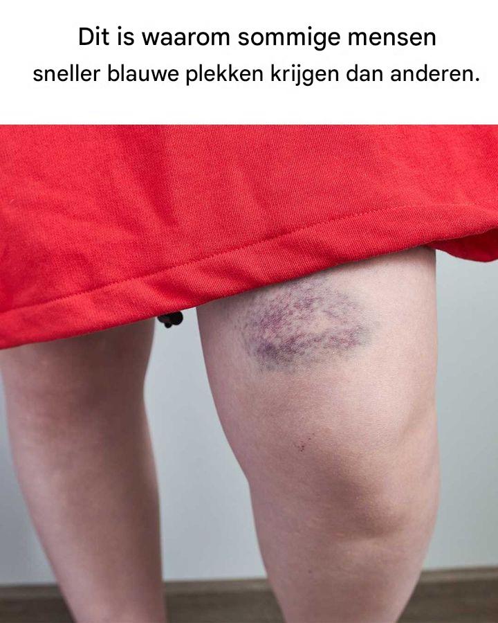 Dit overkomt me steeds weer en ik heb nooit geweten waarom! Nu wel! Wist jij dit al?