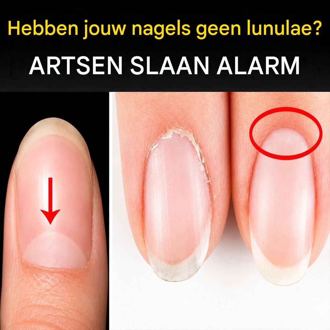 Transformeer je nagelgezondheid met een natuurlijke remedie