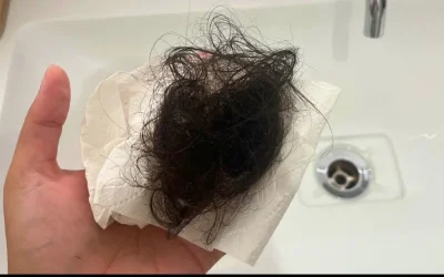 Wist je dat als je haar uitvalt, het een symptoom kan zijn van….