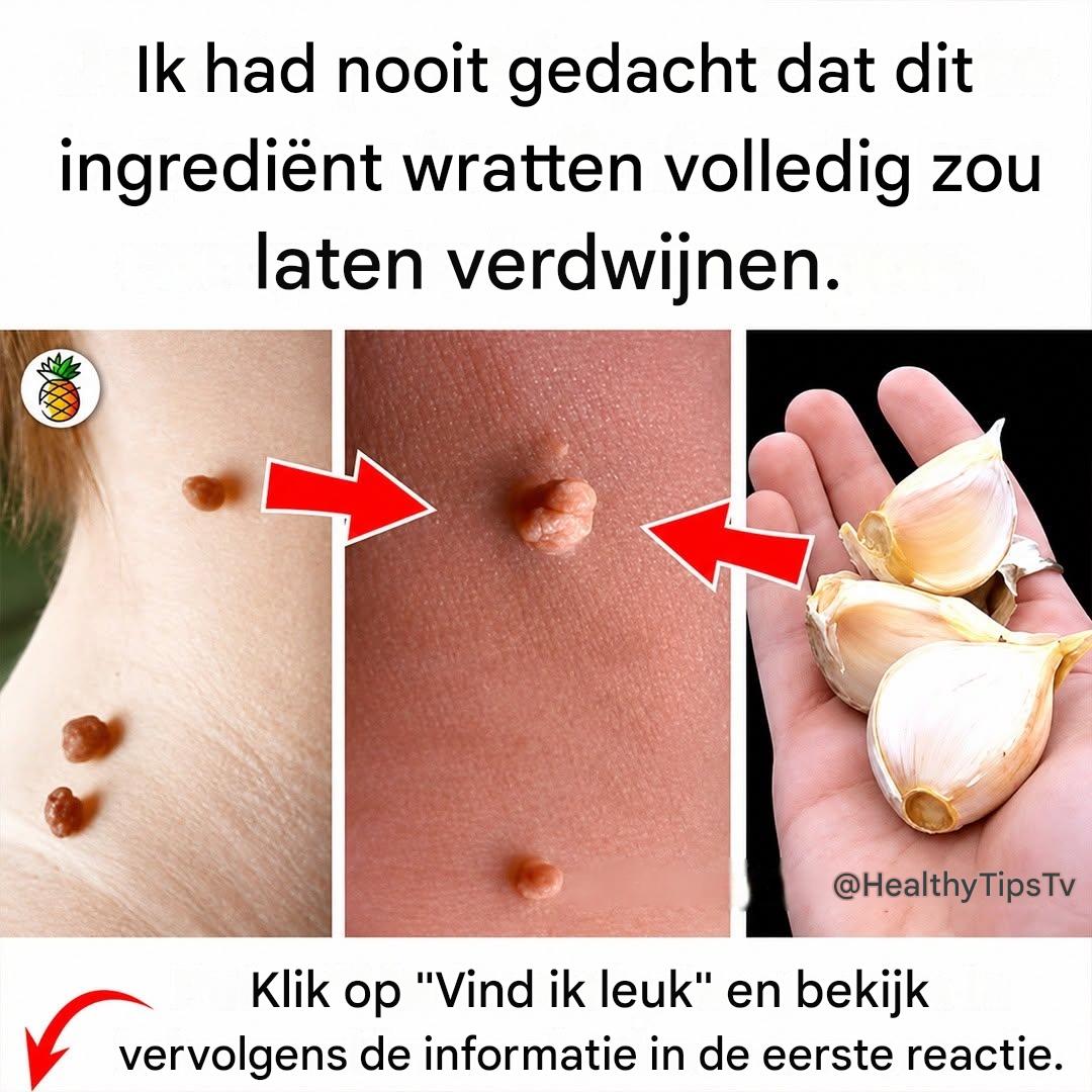 WRATTEN VALLEN ERAF ALS BLADEREN DOOR ALLEEN AL DEZE THUISBEHANDELING TOE TE PASSEN
