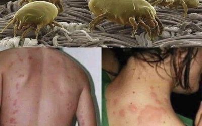 Elimineer de miljoenen mijten die zich ophopen in het matras: wat je moet weten en hoe je ervan af komt