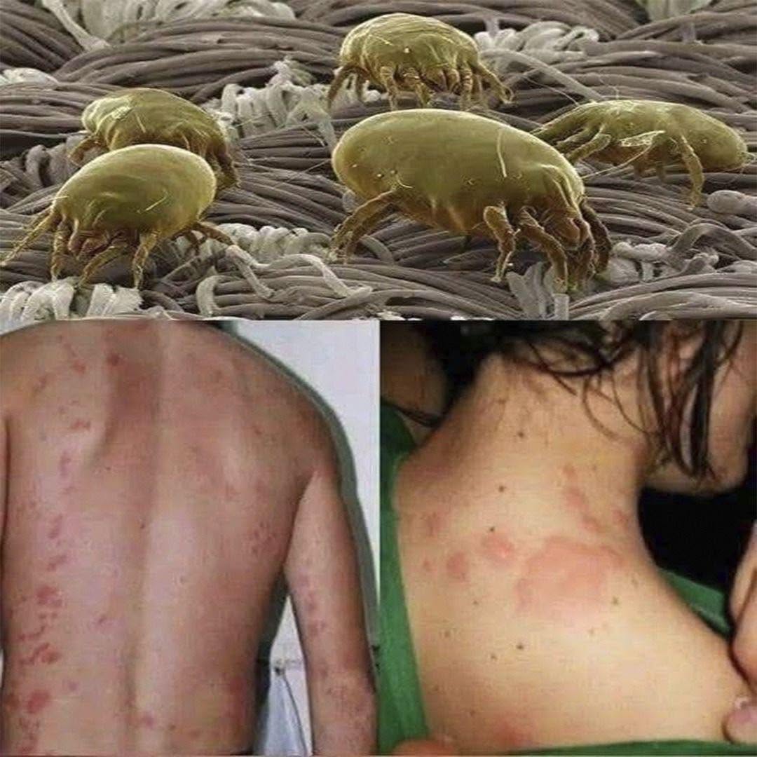 Elimineer de miljoenen mijten die zich ophopen in het matras: wat je moet weten en hoe je ervan af komt
