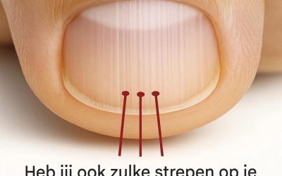 Nagelstrepen: Wat je lichaam je misschien probeert te vertellen