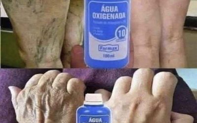 Ongelooflijke toepassingen van waterstofperoxide waar je waarschijnlijk niet van wist,
