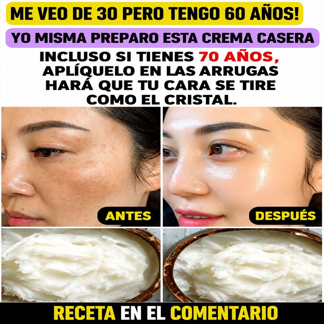 Vaarwel rimpels over enkele minuten met dit eenvoudige masker van aloë, maïzena en honing 👀👇. Om recepten te blijven ontvangen, zeg het gewoon… Dank je!