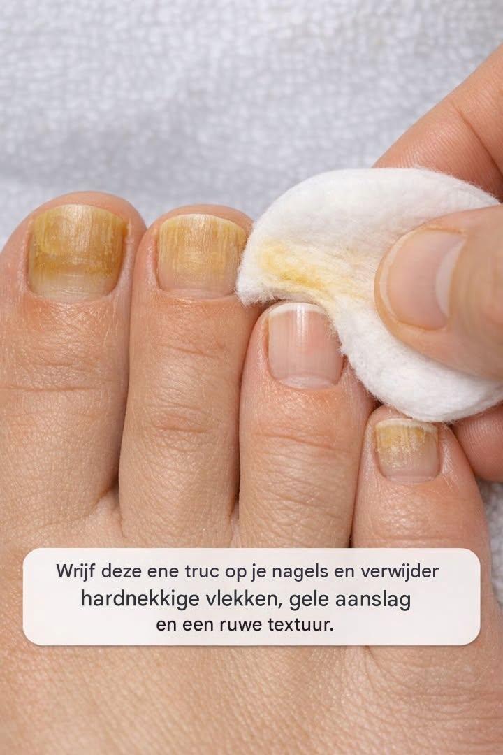 Wrijf deze ene truc op je nagels en verwijder hardnekkige vlekken, gele ophoping en ruwe textuur