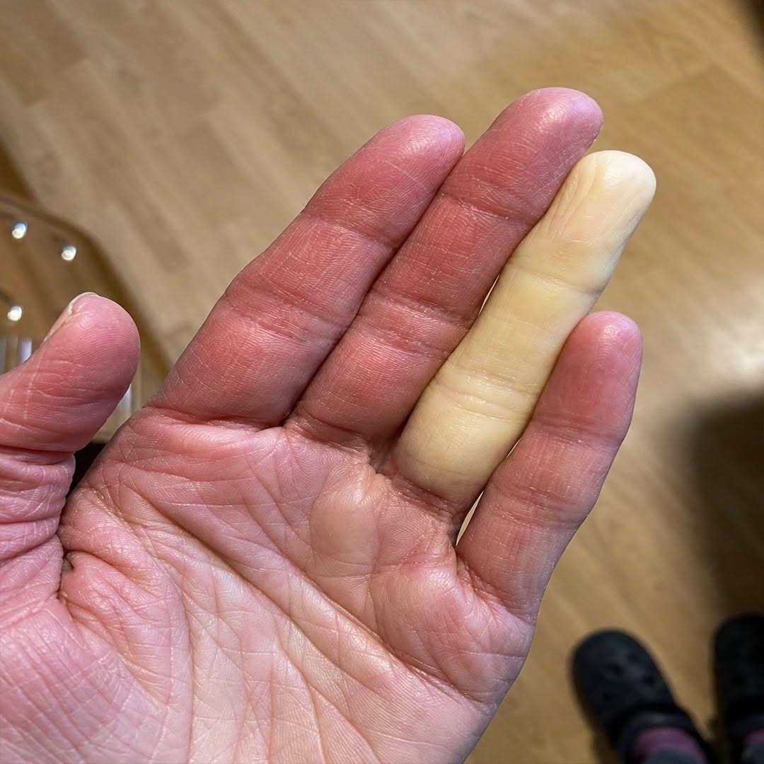 De gevolgen van slapen met je mobiele telefoon: een gewoonte die gevaarlijker is dan je denkt.