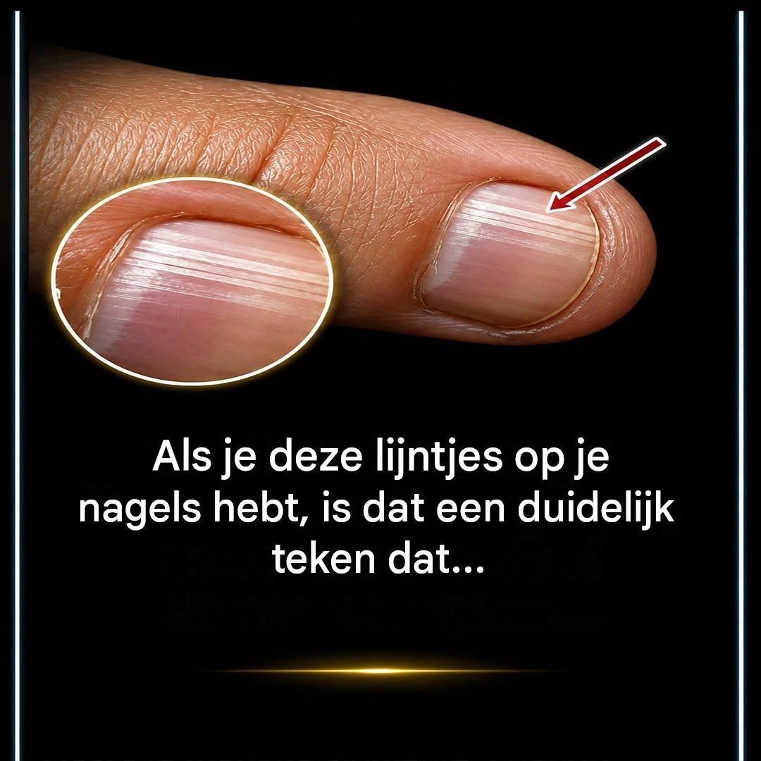 Verbeter de gezondheid van je nagels met een natuurlijk middel.