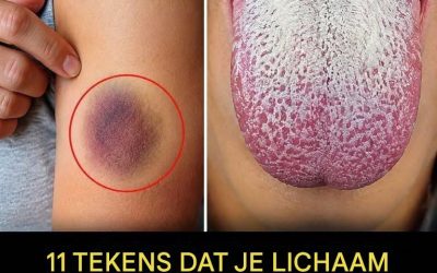 11 signalen dat je lichaam je belangrijke waarschuwingen geeft… Lees meer