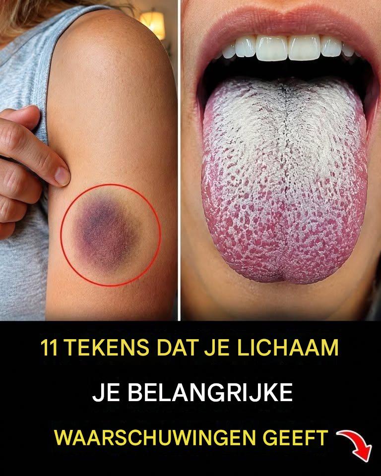 11 signalen dat je lichaam je belangrijke waarschuwingen geeft… Lees meer