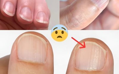 Dokter onthult 7 gezondheidsproblemen die verborgen zitten in je nagels