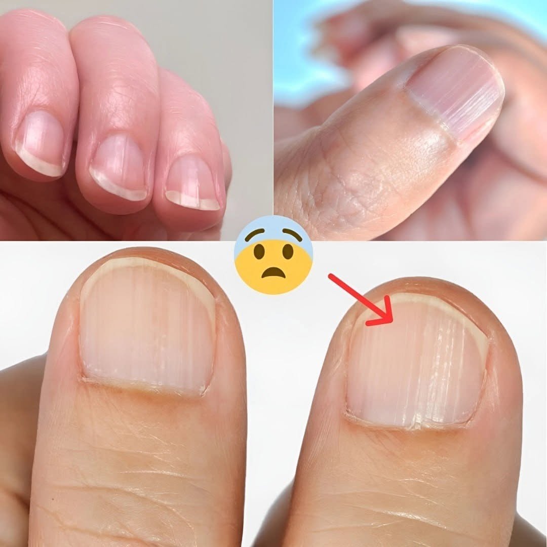 Dokter onthult 7 gezondheidsproblemen die verborgen zitten in je nagels