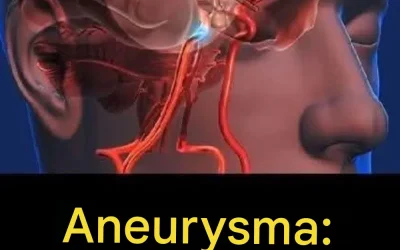 Aneurysma: Signalen die je niet mag negeren…