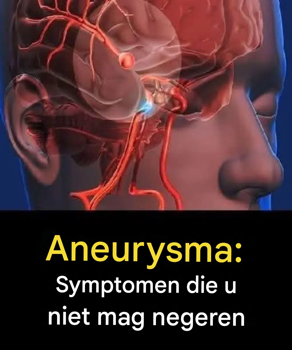 Aneurysma: Signalen die je niet mag negeren…