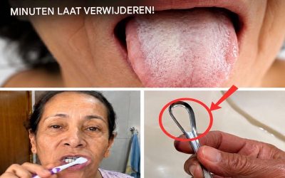 Waarom heb ik een witte tong? Wat je lichaam je wil vertellen