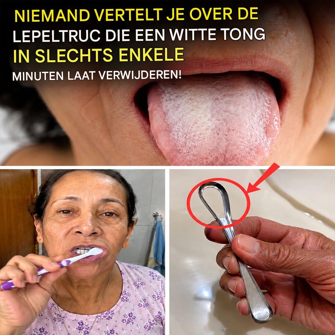 Waarom heb ik een witte tong? Wat je lichaam je wil vertellen