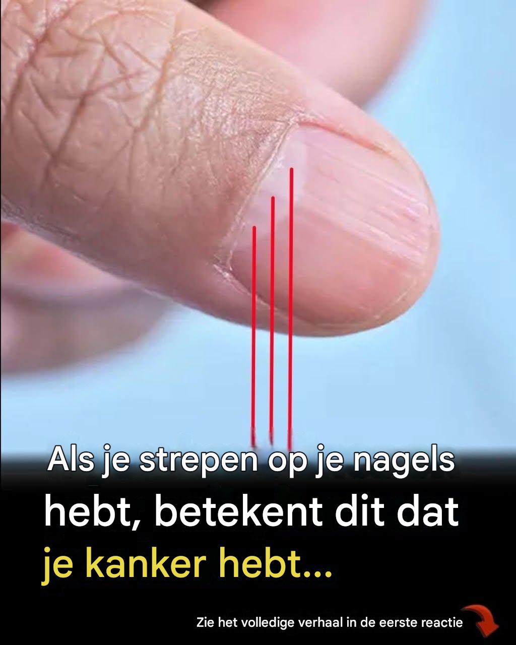 Arts ontdekt een duidelijk teken in je nagels dat je levensverwachting kan voorspellen
