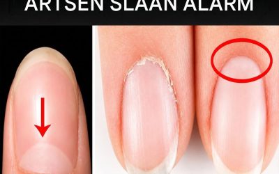 Transformeer je nagelgezondheid met een natuurlijke remedie