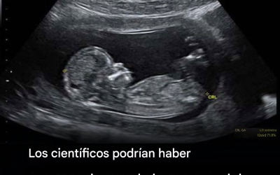 Wetenschappers onderzoeken een mogelijk verband tussen de darmgezondheid van moeders en autisme, maar dit is wat we er echt over weten.