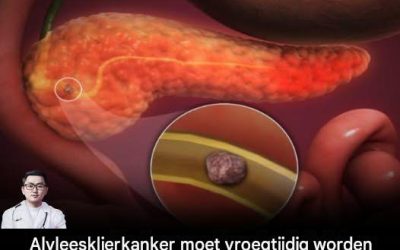 10 tekenen van alvleesklierkanker die u nooit mag negeren