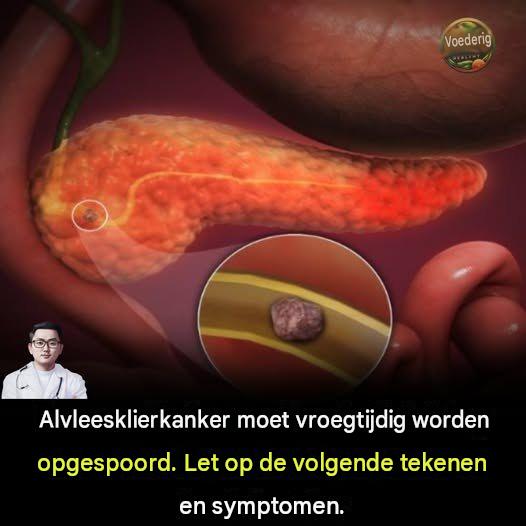 10 tekenen van alvleesklierkanker die u nooit mag negeren