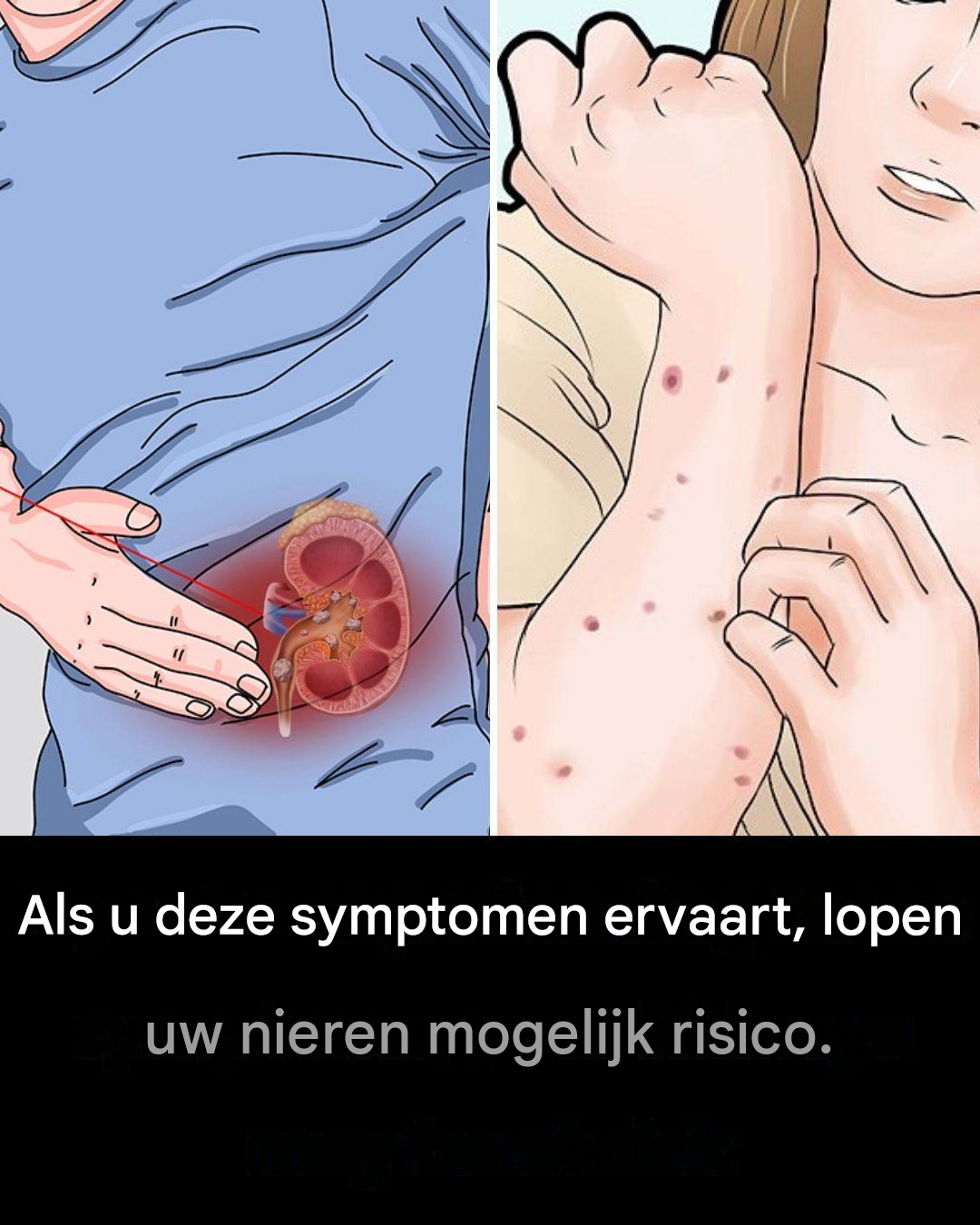 Hoe herken je vroege tekenen van nierziekte en hoe bescherm je je niergezondheid?