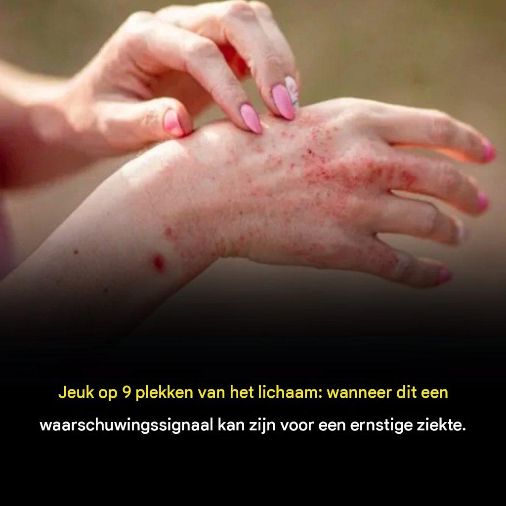 9 soorten jeuk die kunnen wijzen op ernstige gezondheidsproblemen